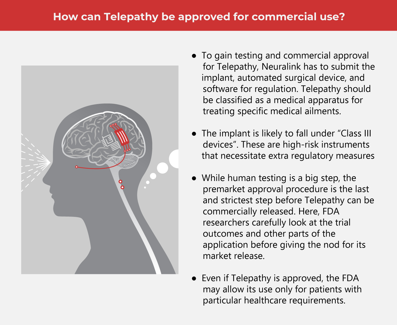 Brain Implant