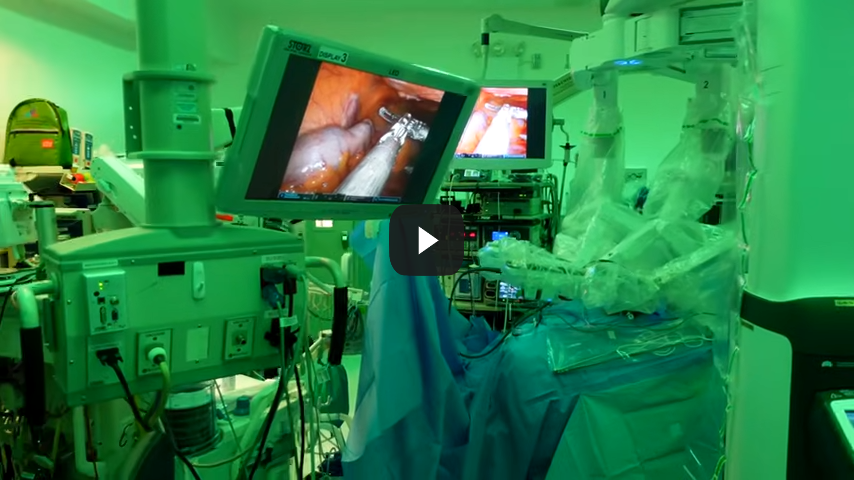 Robotic Assisted Surgery